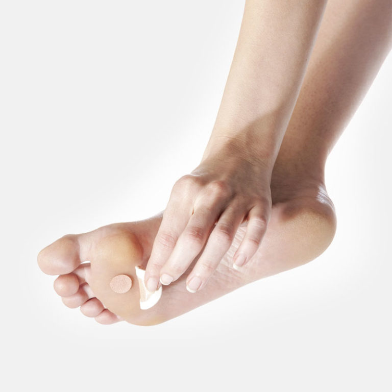 CORN REMOVING PLASTERS Do Tobell